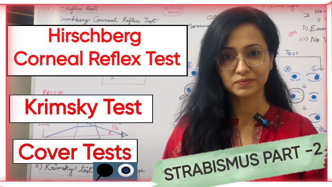 Strabismus Part 2 | Hirschberg Corneal Reflex Test | Krimsky Test | Cover Tests