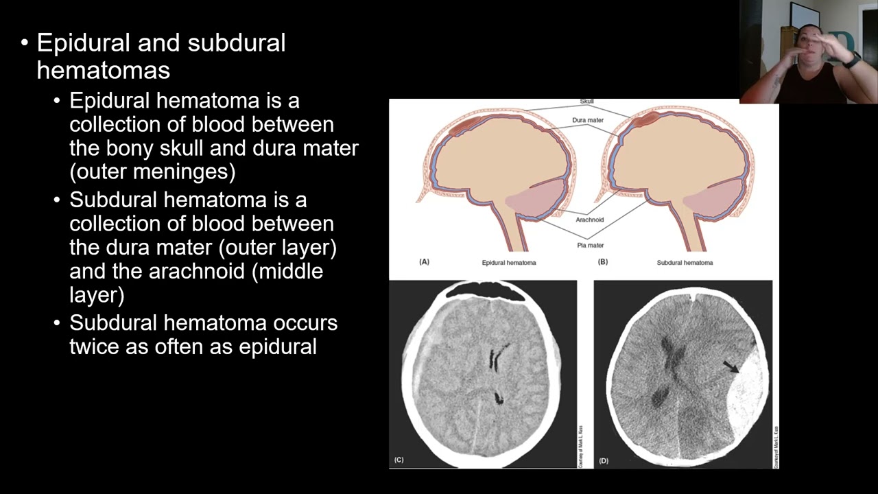 Nervous System Disease & Disorders: Part 3
