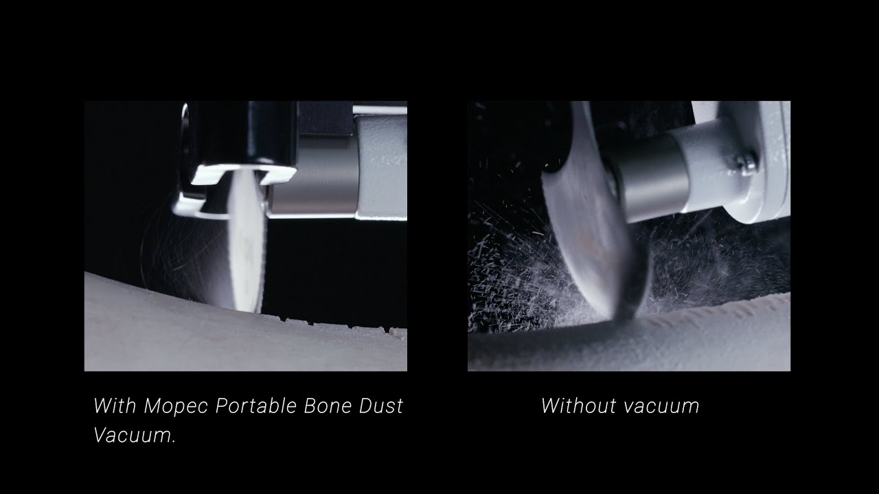 It's Time To Stop Breathing Bone Dust | Introducing the Mopec Portable Bone Dust Vacuum