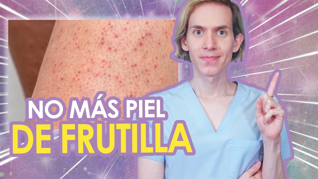 Queratosis pilaris (Piel de gallina o frutilla) - QUÉ ES y CÓMO ELIMINARLA  - Simon Scarano