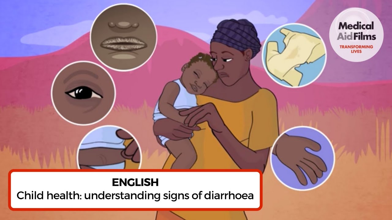 Child health: understanding signs of diarrhoea