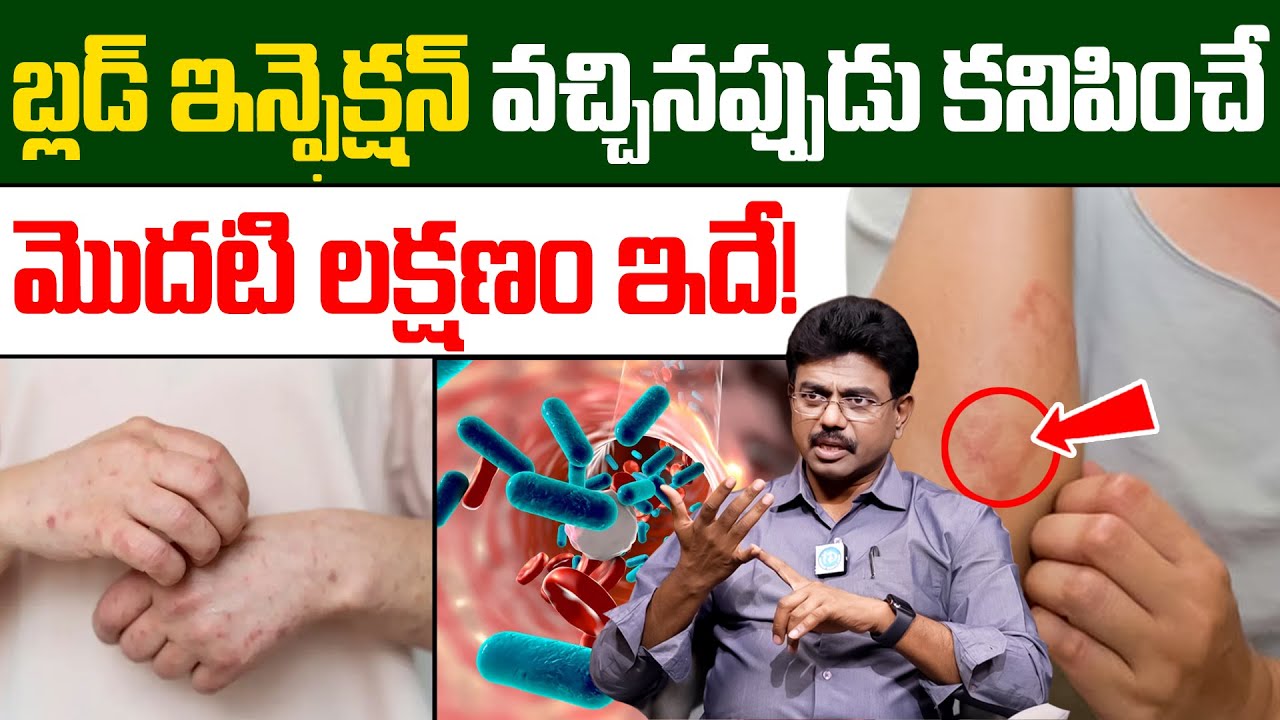బ్లడ్ ఇన్ఫెక్షన్ వచ్చినప్పుడు కనిపించే మొదటి లక్షణం ఇదే! | Blood Infection Symptoms | Dr Rajesh