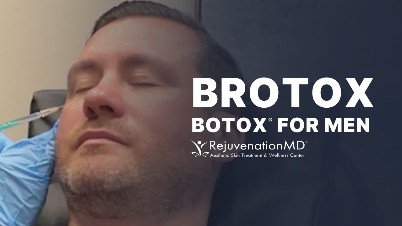 Botox for Men: Treat Crow&rsquo;s Feet, Glabella, and Forehead