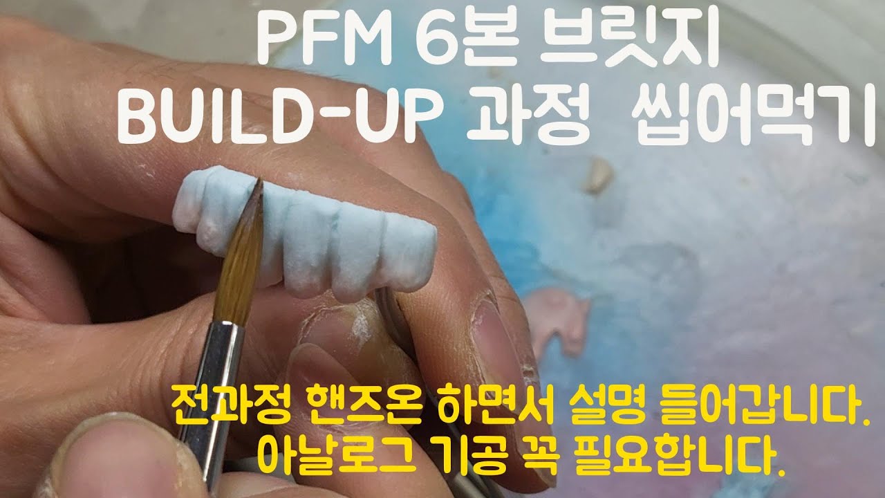 #1. //build- up//오랜만에하는 아날로그기공 PFM 6본브릿지 빌드업하면서 설명들어갑니다.