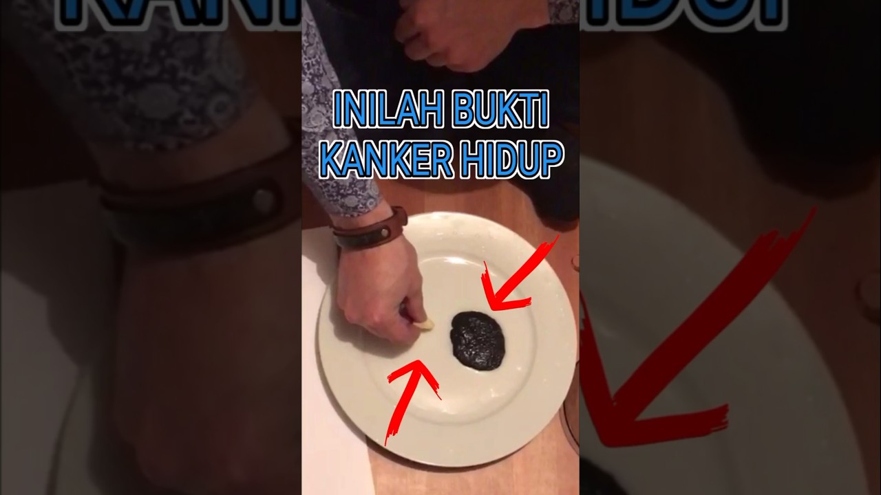 Ini Bukti Kalo Kanker Hidup