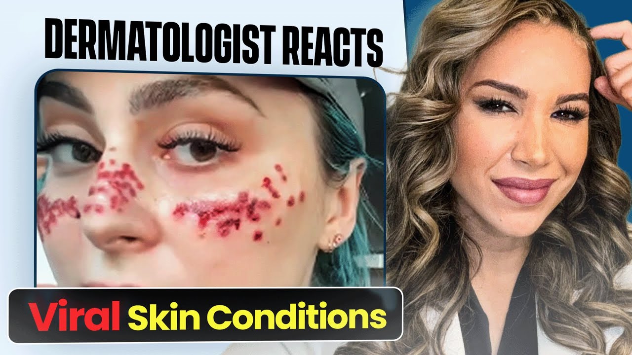 Reacting to Viral Skin Conditions with a Dermatologist!