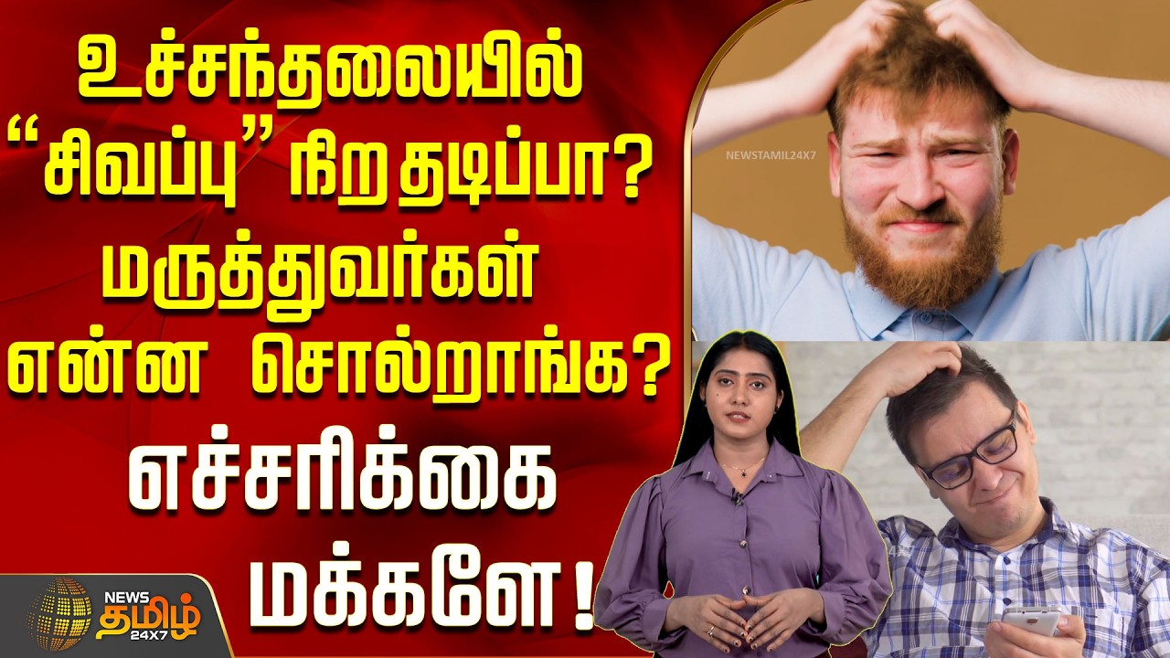 உச்சந்தலையில் “சிவப்பு” நிற தடிப்பா? மருத்துவர்கள் என்ன சொல்றாங்க?எச்சரிக்கை  மக்களே? | Health Alert
