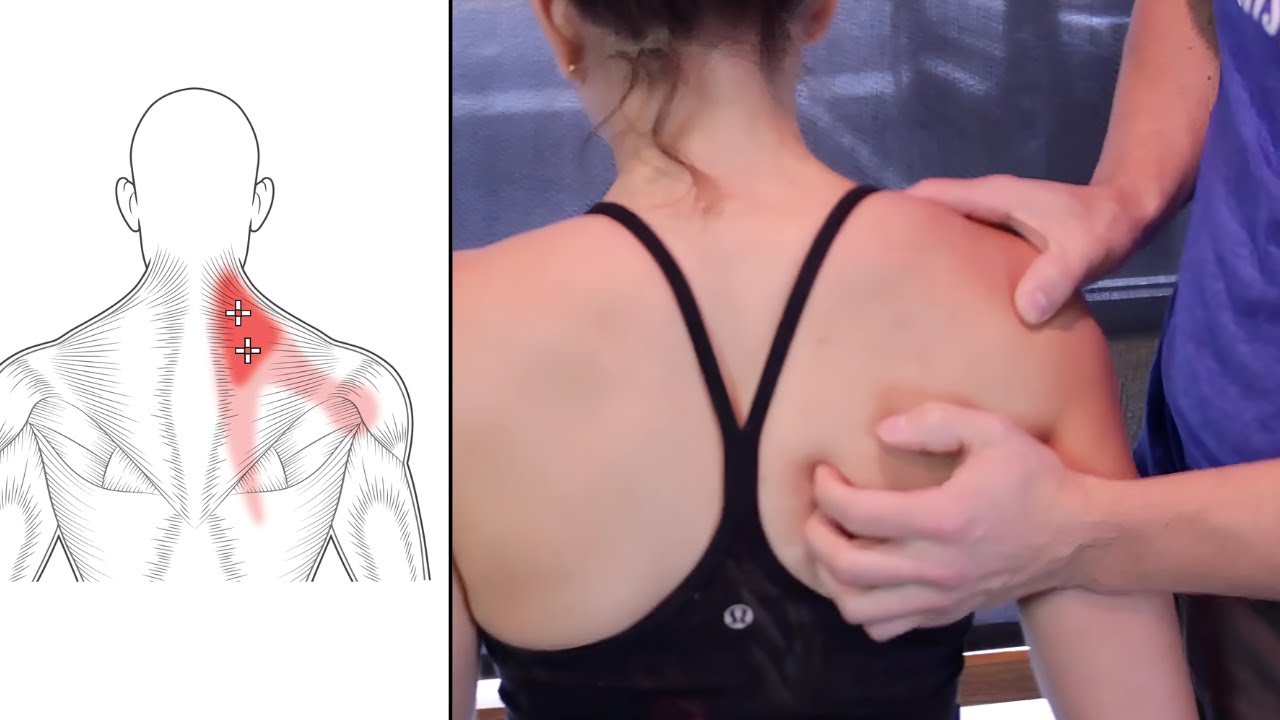 Rhomboid or Shoulder Blade Pain? Try This Updated Solution (2025)