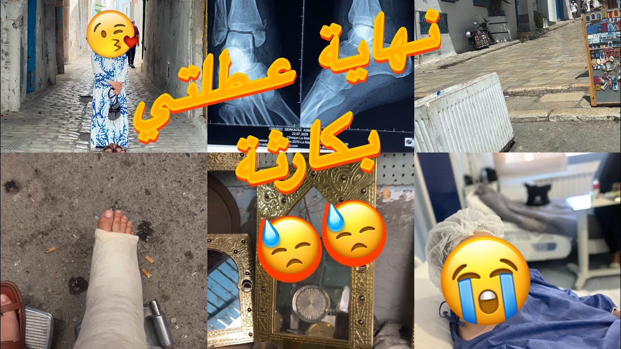 قدر الله ماشاء فعل 🥺 تكسرت رجلي و درت عملية مستعجلة و الحمدلله 