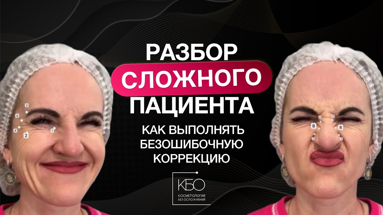 Ботулинотерапия. Разбор «Сложного» пациента: как выполнять безошибочную коррекцию
