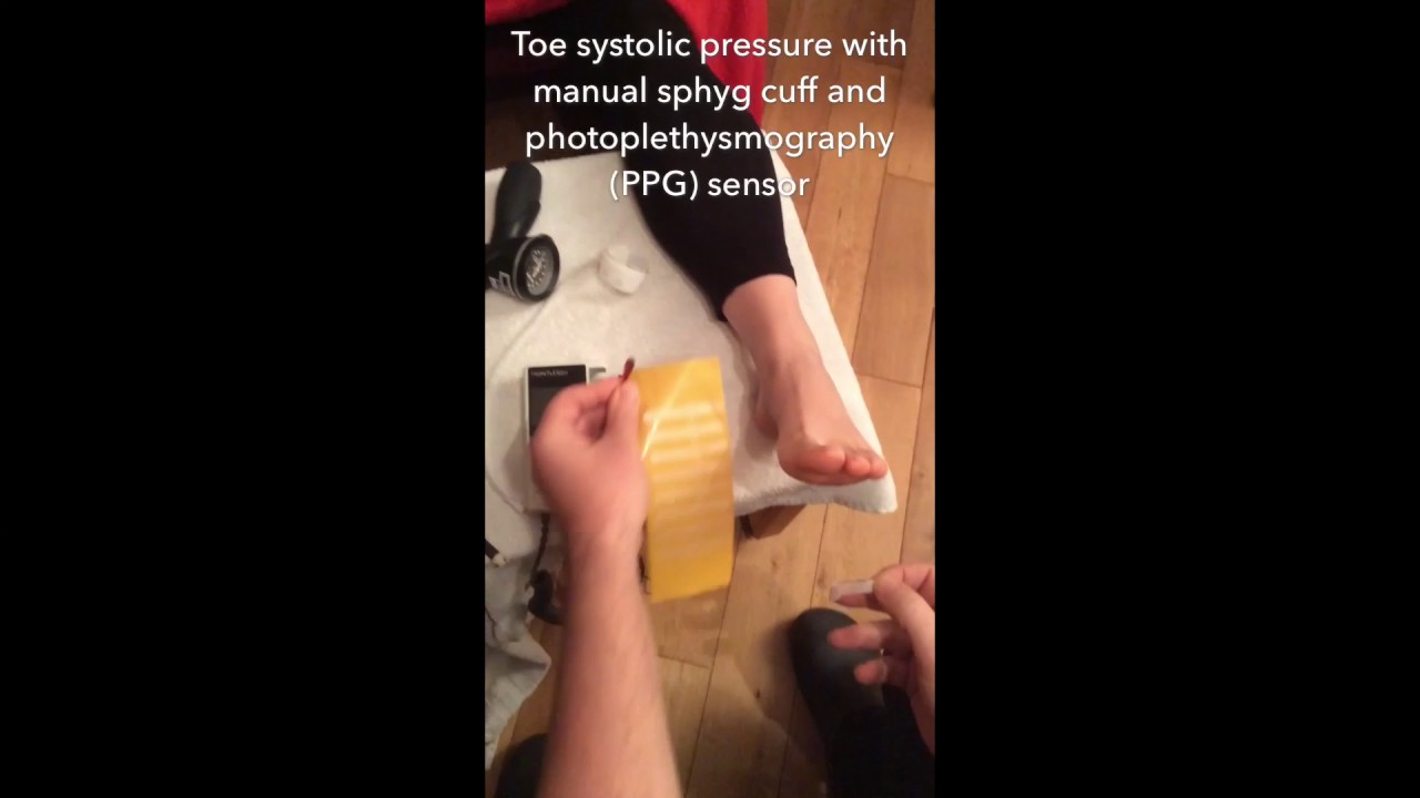 Toe Taking a toe systolic pressure with a sphyg & PPG sensor