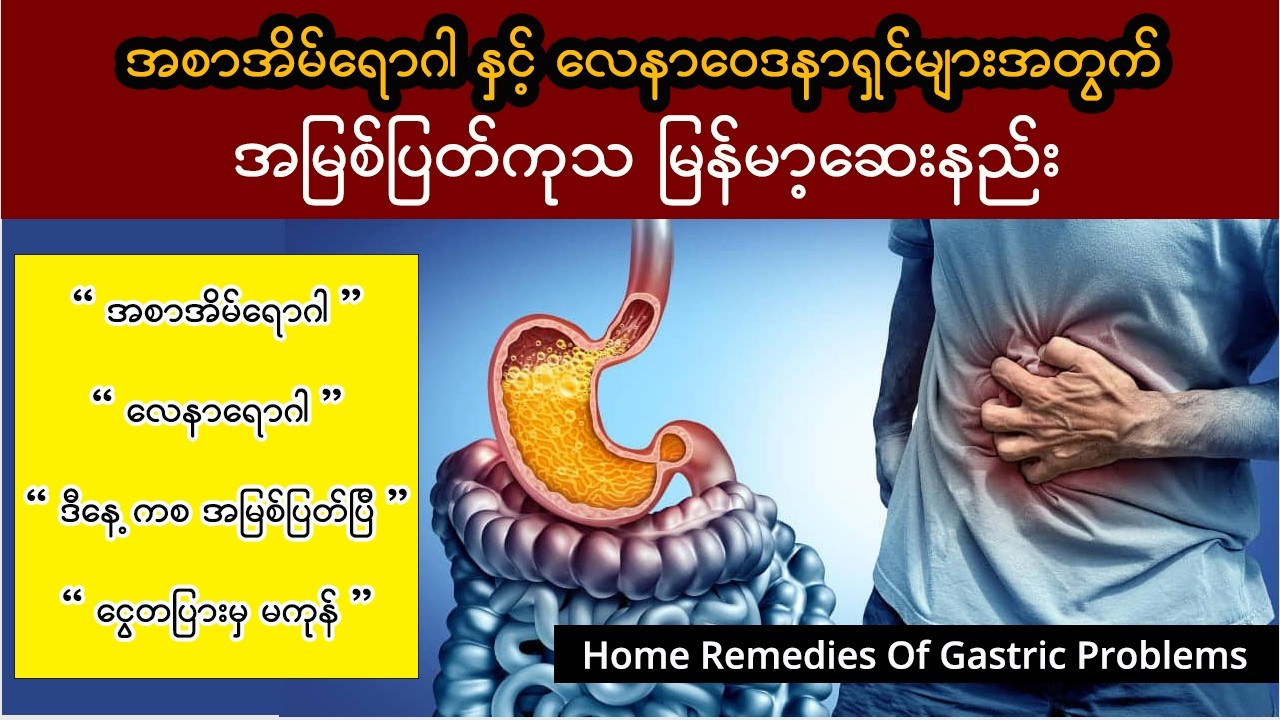 အစာအိမ်ရောဂါနှင့် လေထိုးလေအောင့်ခြင်းကို ဆေးသောက်စရာမလိုဘဲ ကုသနည်း (အိမ်တွင်းကုထုံးအစုံအလင်)
