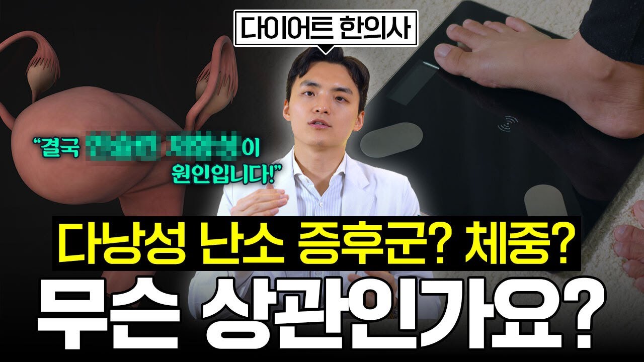 체중 5%만 줄여도 다낭성난소증후군 증상 좋아지는 이유