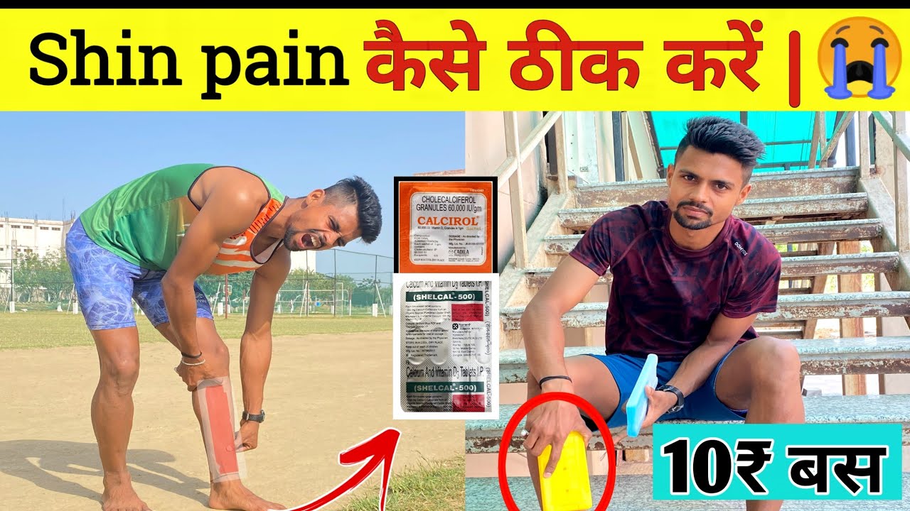 Shin pain kaise thik kare 😭| Shin pain treatment in hindi | शिन पैन कैसे ठीक करें 💥 ✅️