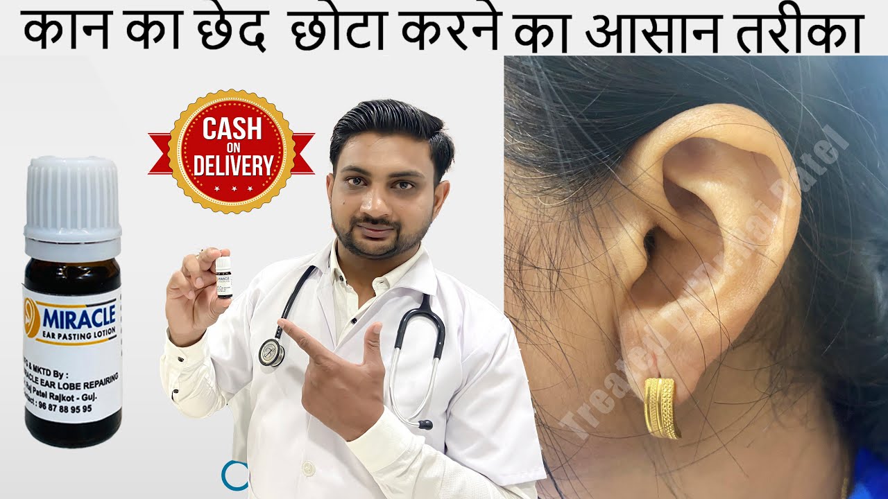Earlobe / Hole Repair By Ear Pasting lotion / Ear Repair/ Torn Ear lobe Repaired Earlobe -9687889595