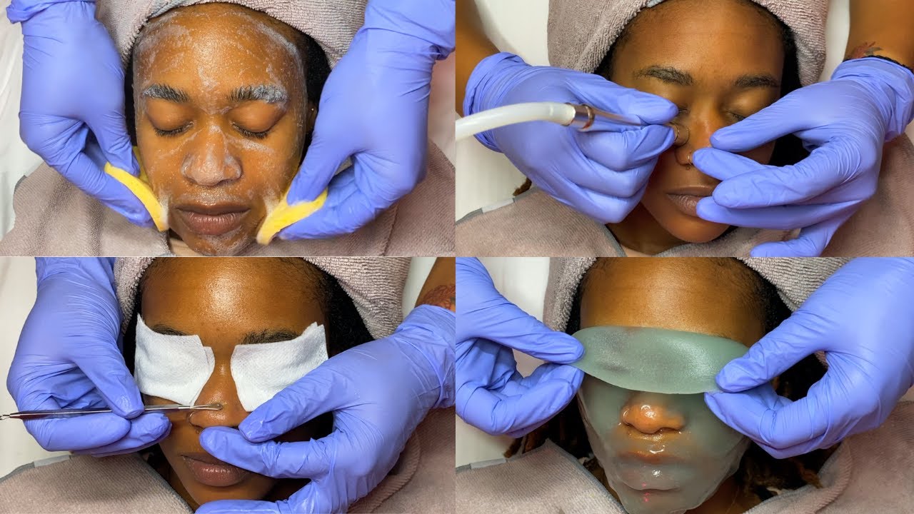 Correcting Hyperpigmentation + Radiance | GlamByLiaLeigh