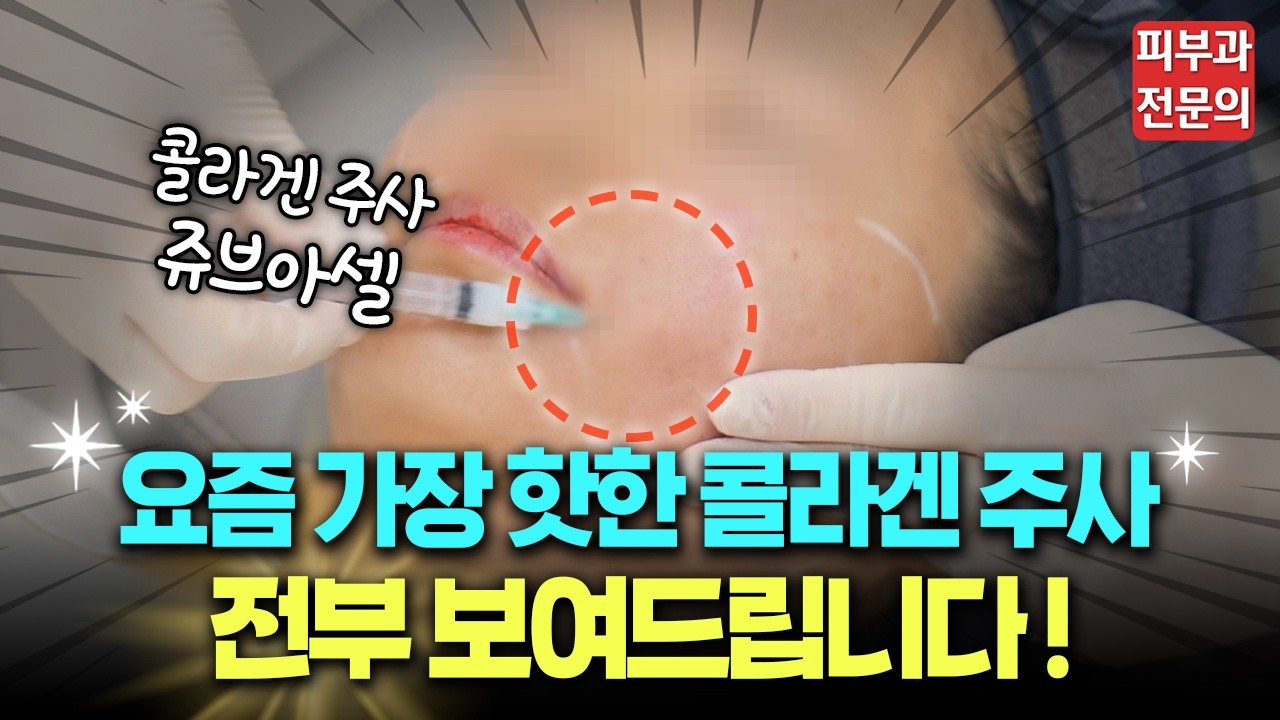 잔주름, 자글자글한 피부결을 가장 확실하게 펴는 법!ㅣ혁신적인 콜라겐주사 쥬브아셀, 직접 보여드립니다! 🔍