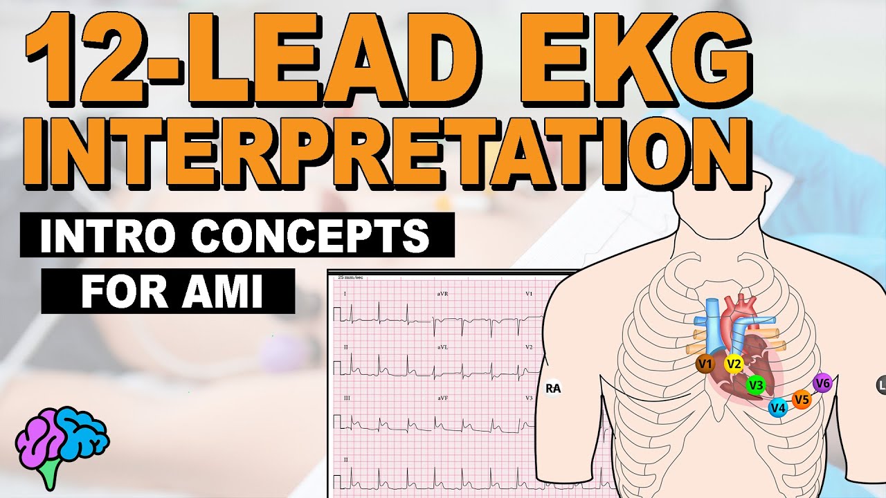 Introductory Concepts for Acute Myocardial Infarction (AMI) on 12-Lead EKG