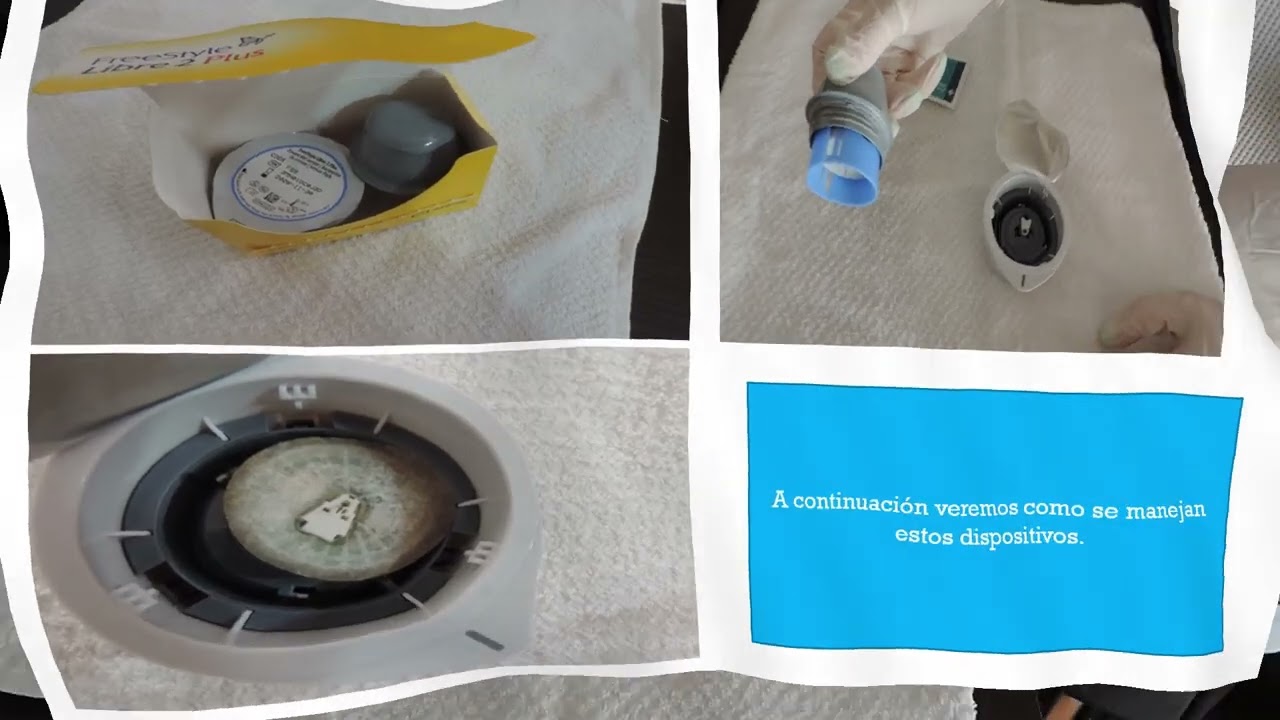 Monitoreo continuo de glucosa