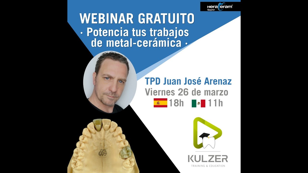 Optimiza tus trabajos de metal-cerámica