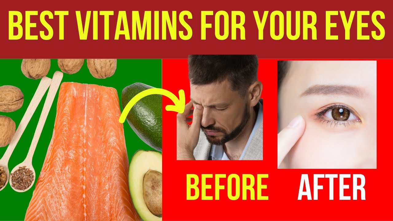 Top 5 Vitamins For Your Eyes