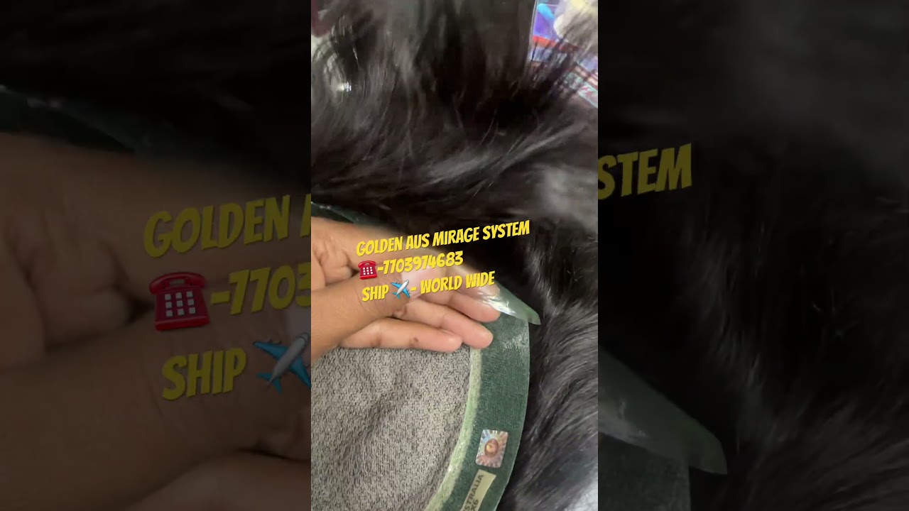 Australia mirage hair system ! #patchupstatus #hairreplacement  #wigs #hairwig #hairlosstreatment