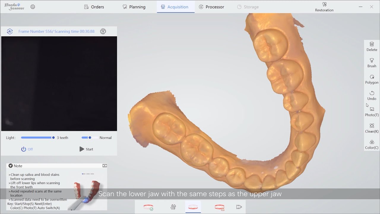 PANDA smart Intraoral Scanner | Restoration Scanning
