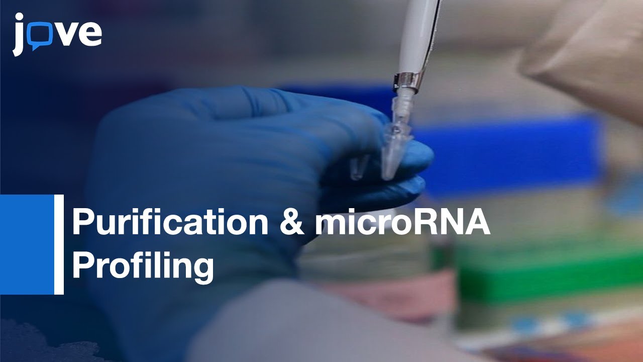 Purification & microRNA Profiling Of Exosomes Derived From Blood & Culture Media l Protocol Preview
