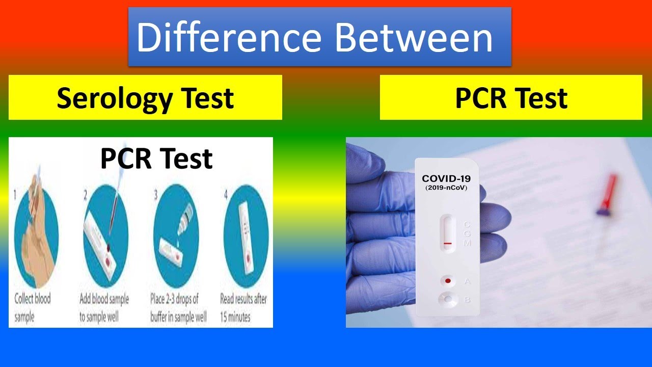 Difference Between Serology Test and PCR Test