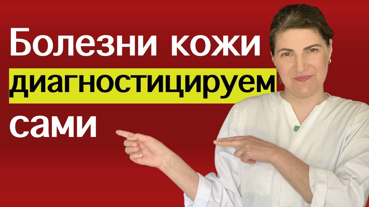 Кожные заболевания - ставим диагноз (принцип симметрии)