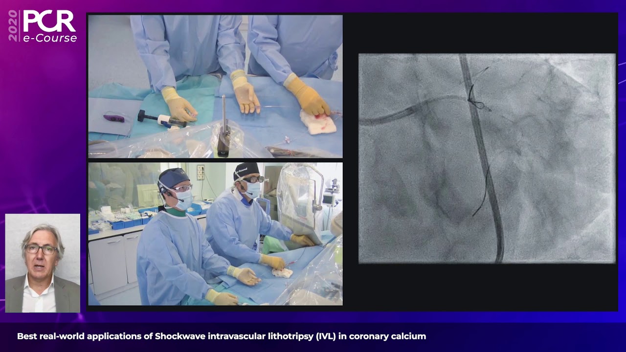 Best real-world applications of Shockwave IVL in coronary calcium - PCR e-Course 2020