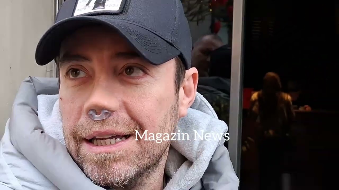 Murat Dalkılıç'a geçici burun takıldı! Dalkılıç sağlığına nasıl kavuşacak