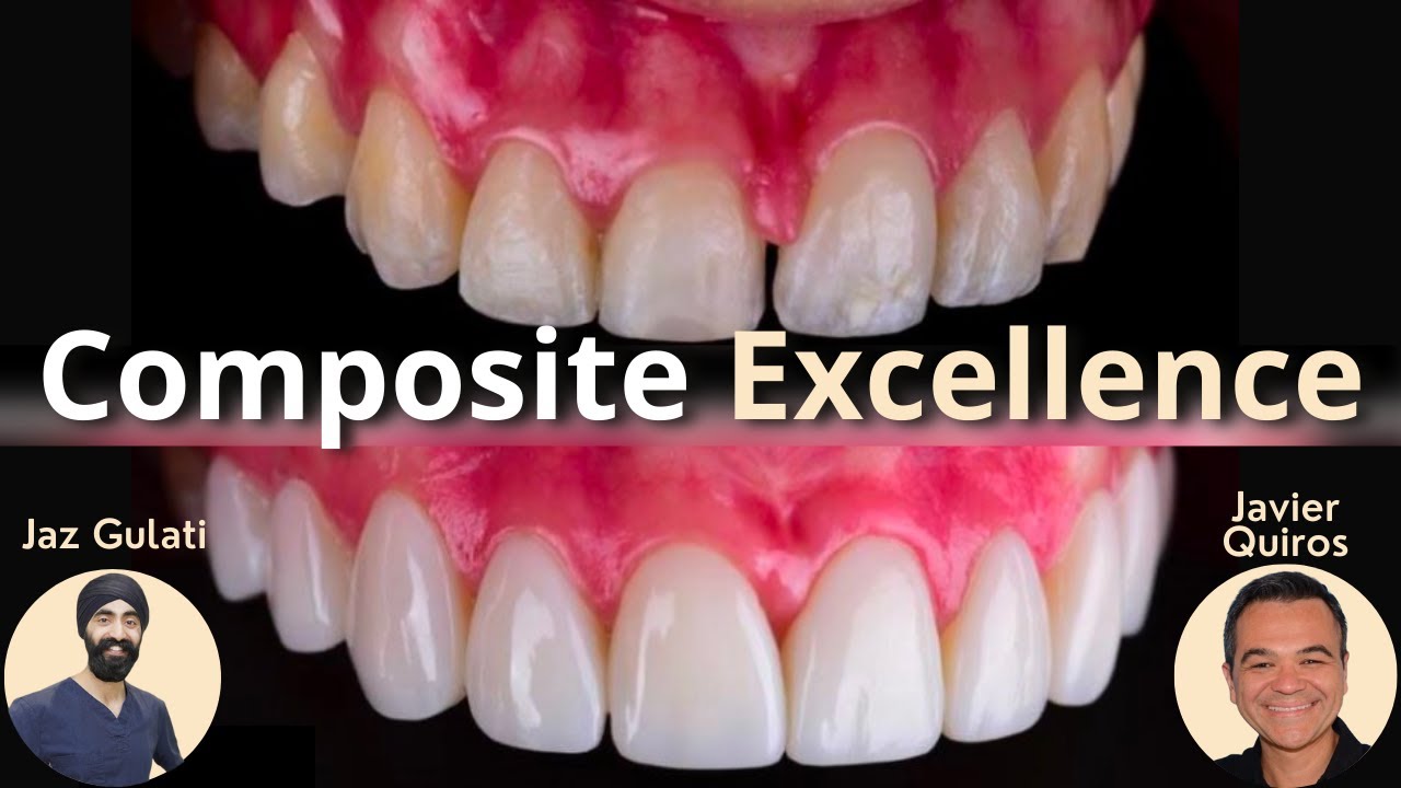 Excellence in Composite Restorations with Dr Javier Quiros