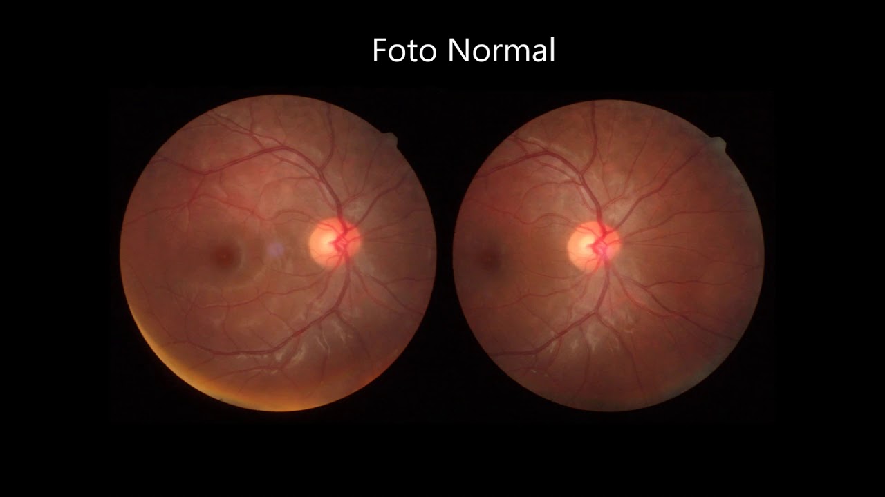 CÁMARA RETINAL NO MIDRIÁTICA AFC 330 - NIDEK