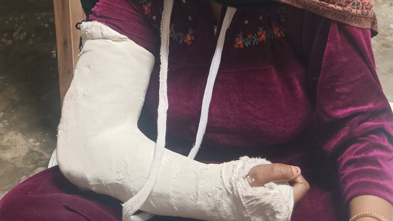  😱😭 Accident Ke Baad Hath Mein Plaster 😞 | Painful Day | Emotional Vlog