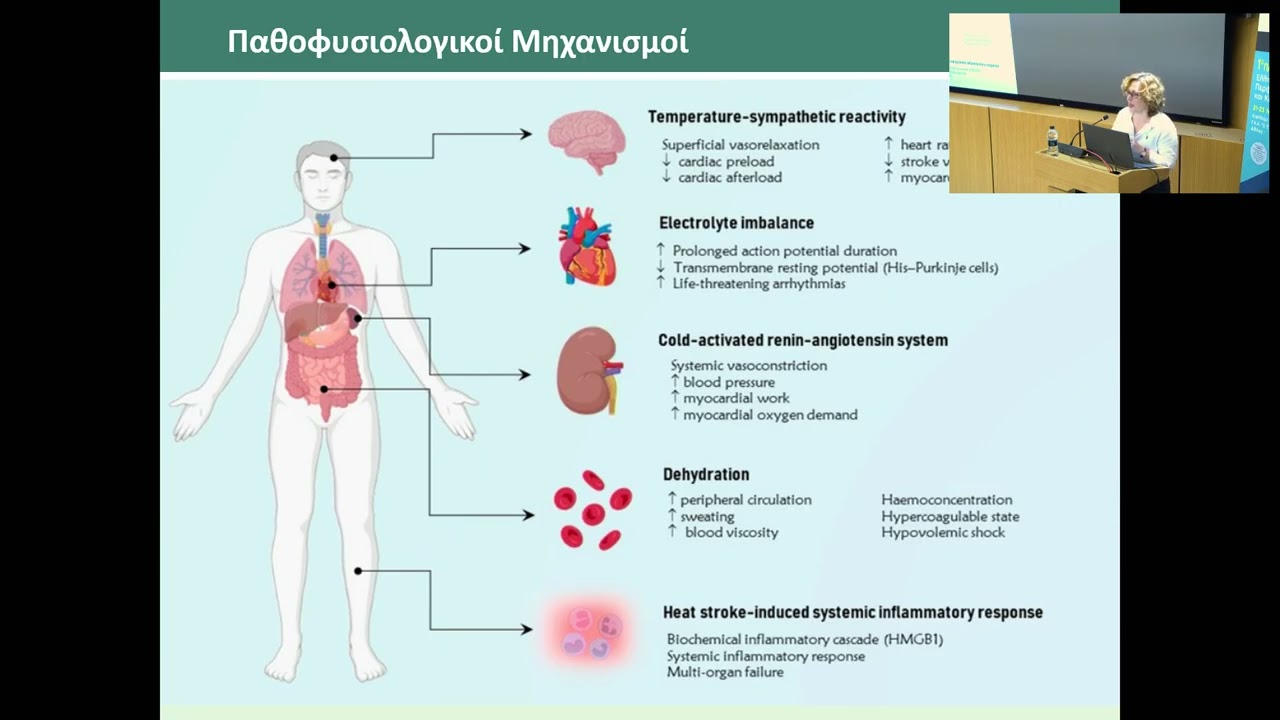 Άνδρας 57 ετών διακομίζεται στο ΤΕΠ τον μήνα Ιούλιο με οξύέμφραγμα του μυοκαρδίου. Α. ΜΠΑΛΑΔΗΜΑ