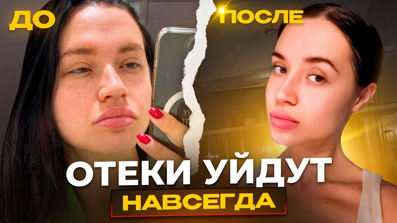 ОТКУДА ОТЕКИ? 7 минут и ты узнаешь причины отеков и как от них избавиться