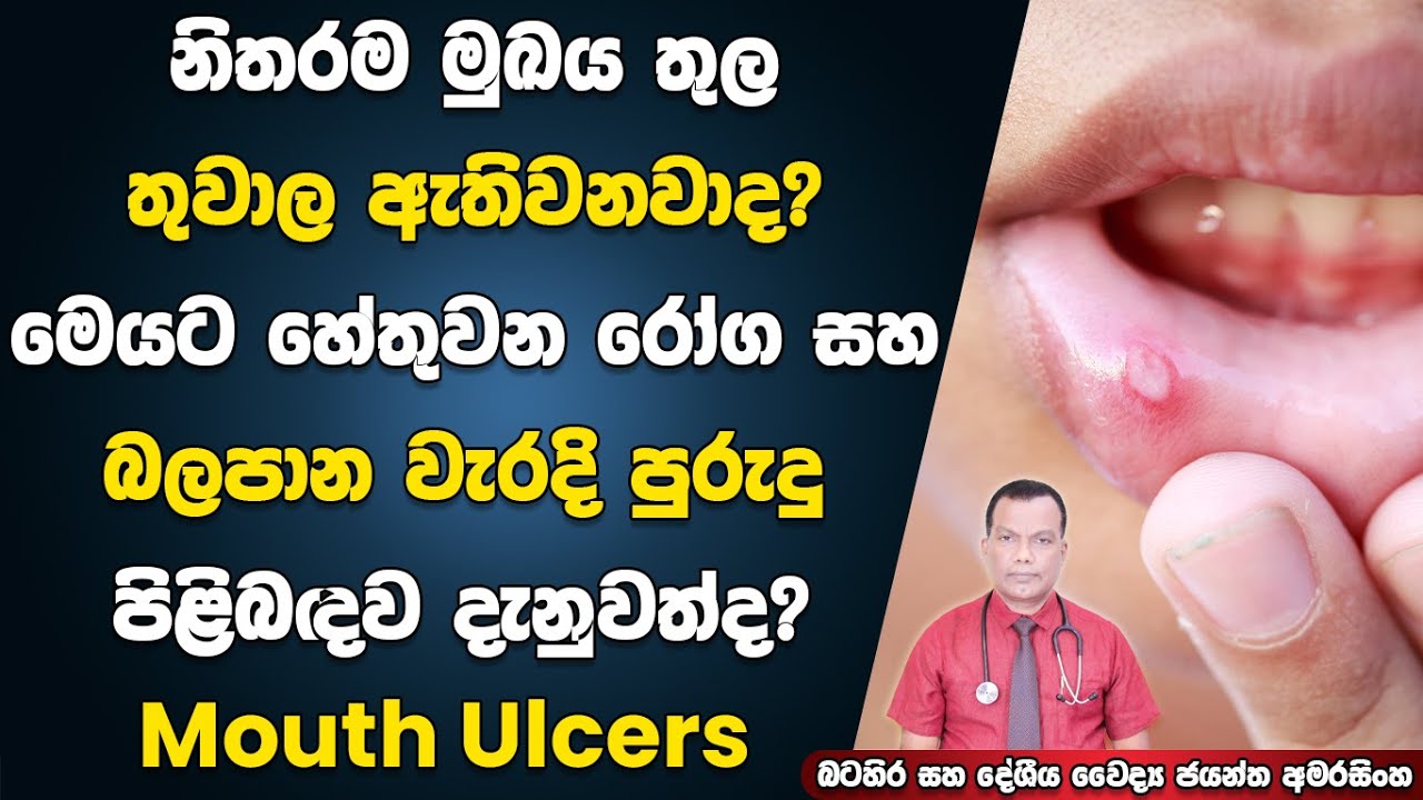 නිතරම මුඛය තුල තුවාල ඇතිවනවද? එයට හේතු වන රෝග තත්ත්ව සහ ඇතිවීමට බලපාන වැරදි පුරුදු පිලිබදව දැනුවත්ද?
