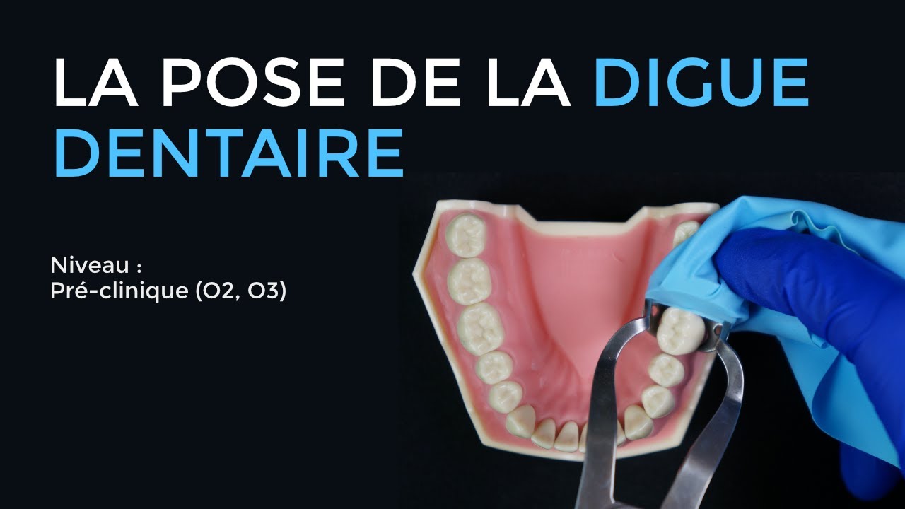 101 - Pose de la digue dentaire