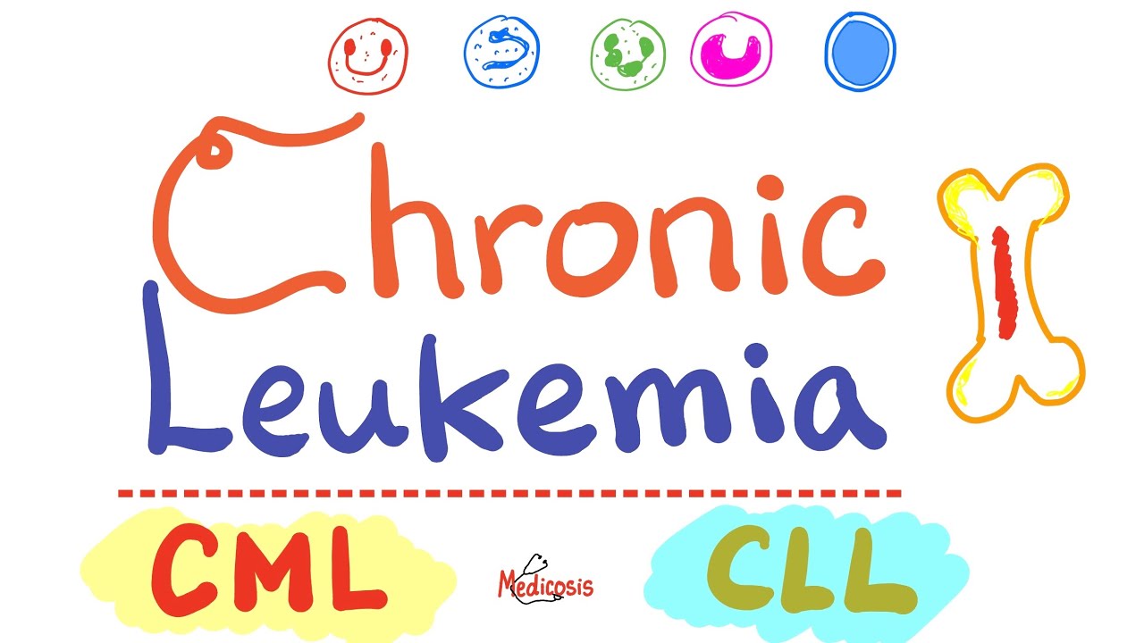 Chronic Leukemias - CML and CLL  - Hematology / Oncology