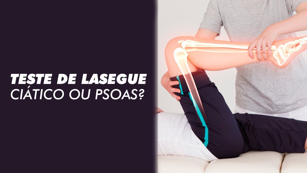 Teste de lasegue: Ci&aacute;tico ou psoas?