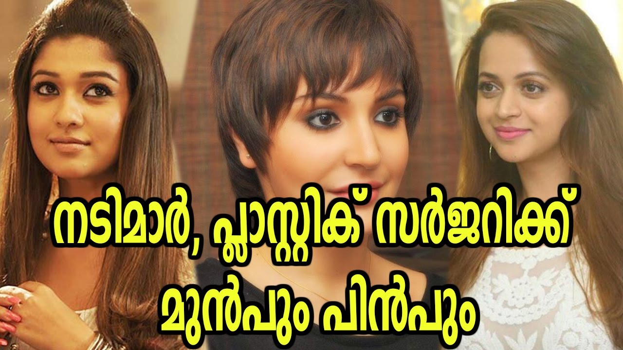 Actresses Before And After Plastic Surgery | Filmibeat Malayalam