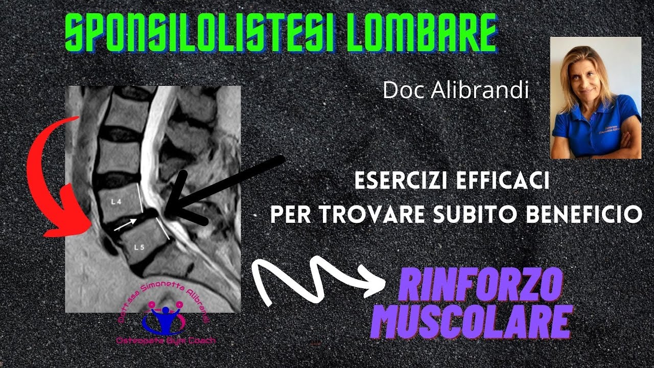 SPONDILOLISTESI E MAL DI SCHIENA LOMBARE:ESERCIZI DI RINFORZO