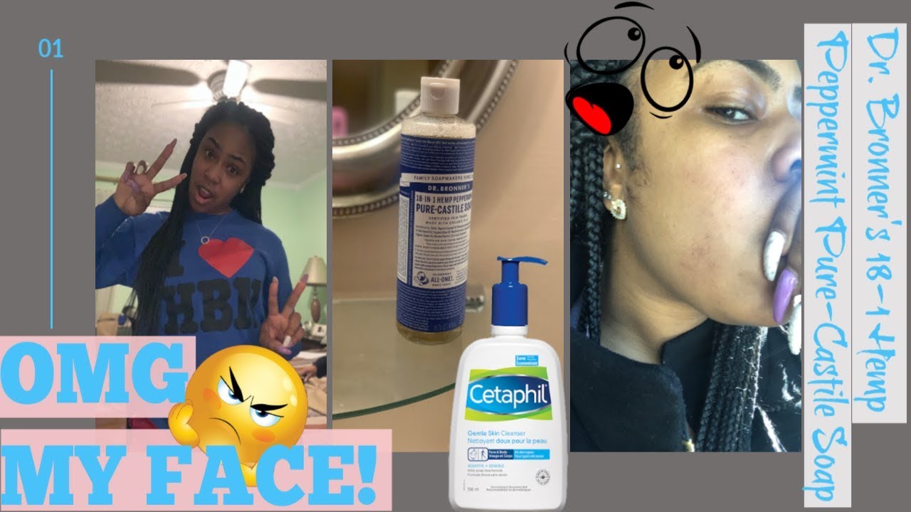 DR BRONNER'S PURE-CASTILE SOAP REVIEW | LOOK AT MY FACE