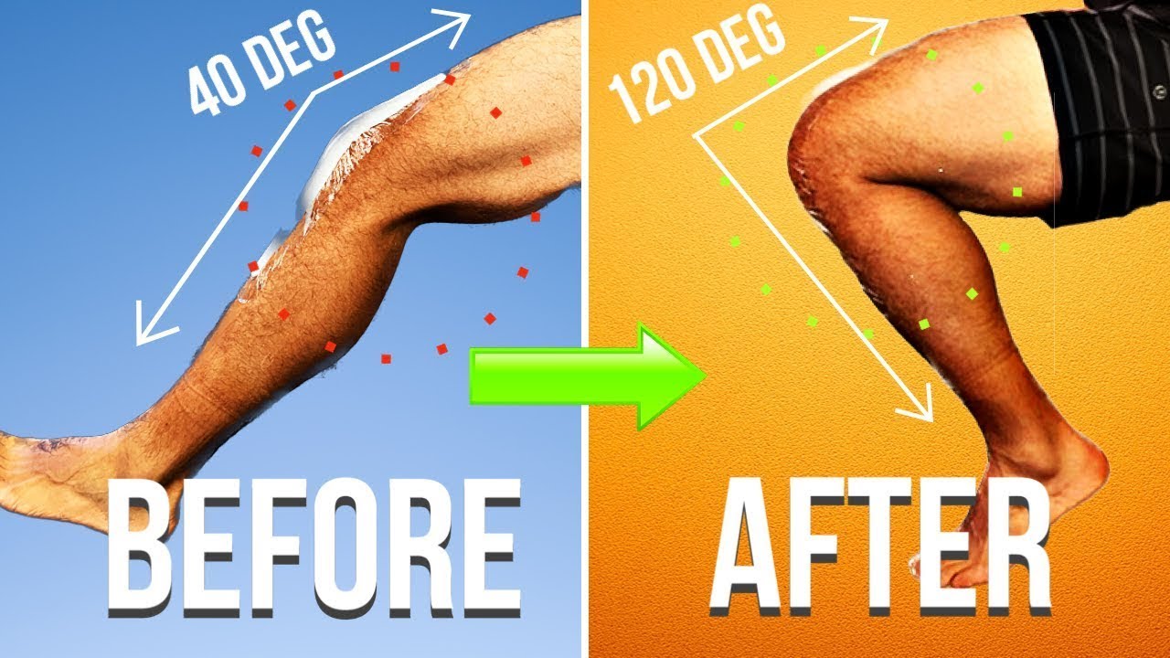 You MUST Do This to Avoid Knee Stiffness After Knee Replacement!