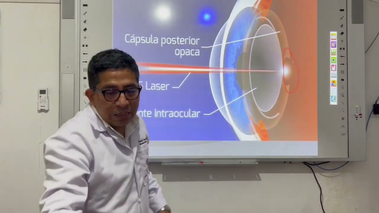 CAPSULOTOMÍA CON YAG LASER (LIMPIEZA DE LENTE)