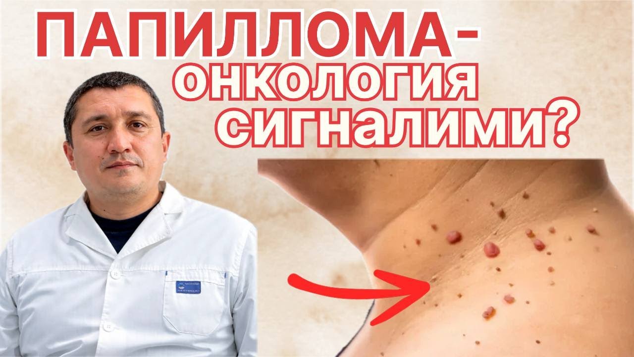 Теридаги кичик шишлар: хавотирли бўлдими?