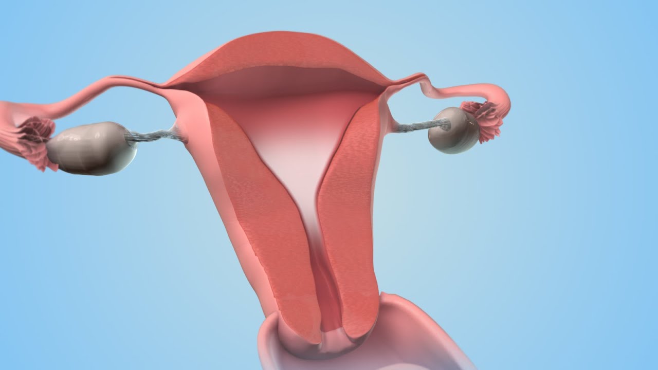 Cervical Cap