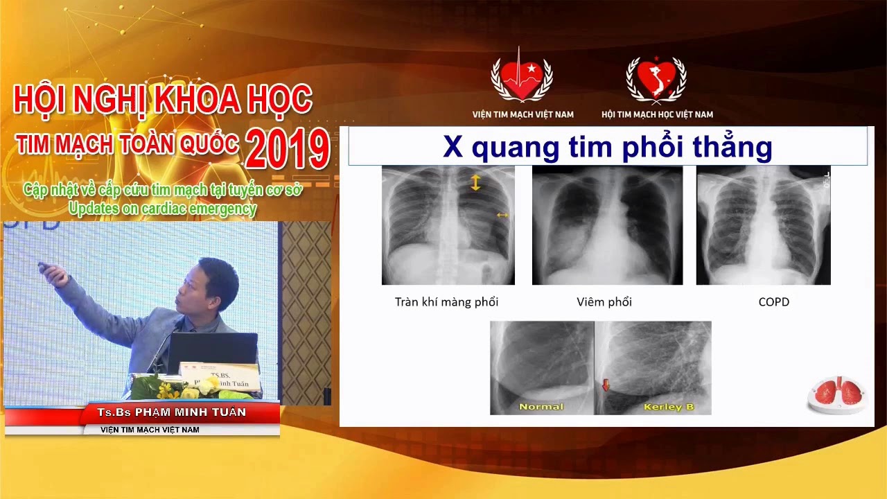 Tiếp cận bệnh nhân KHÓ THỞ