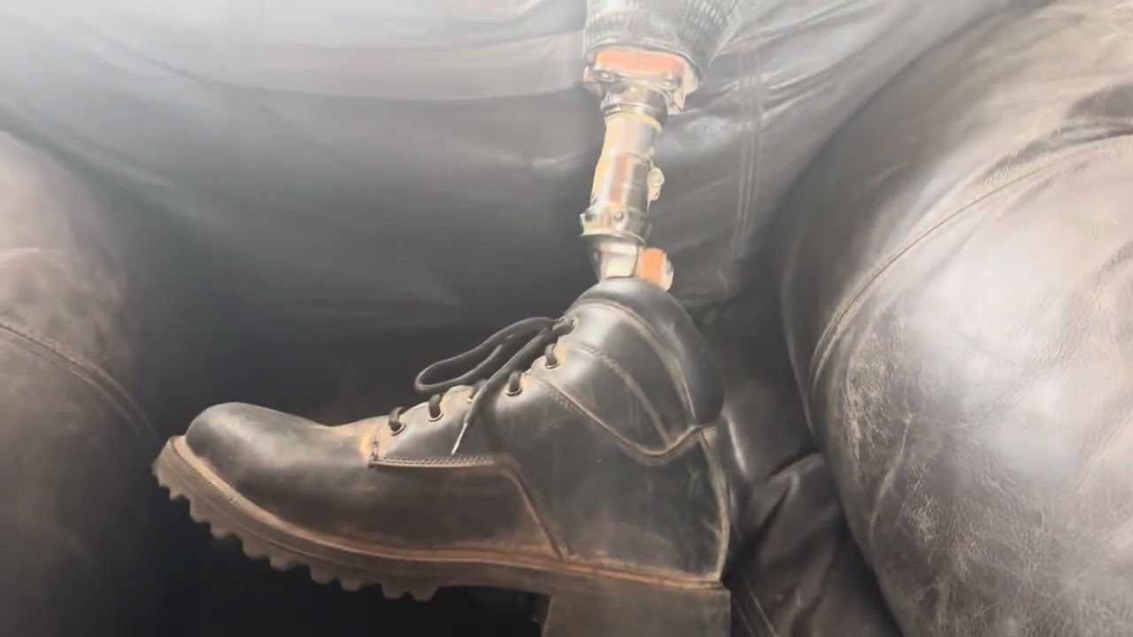 How the one-legged miner came to be